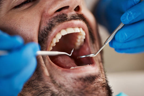 Best Root Canal Emergency Dentist  in Sibley, LA
